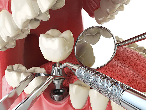Best Emergency Orthodontic Repairs in Darien, IL
